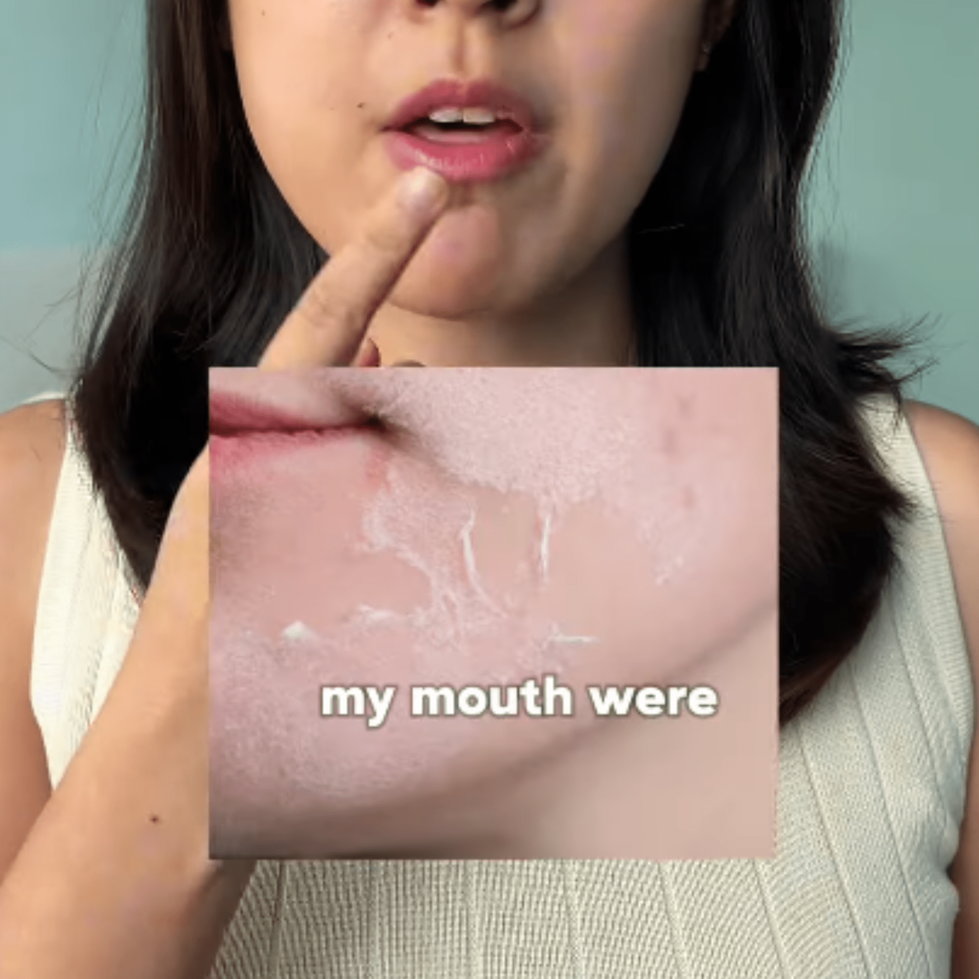 Could Your Dry Skin and Peeling Lips Be a Cry for Help? Diana’s Story Has the Answer